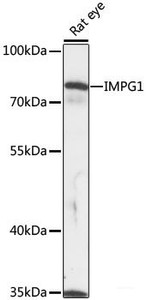 Western blot analysis of extracts of Rat eye using IMPG1 Polyclonal Antibody at dilution of 1:1000.