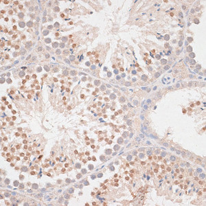 Immunohistochemistry of paraffin-embedded Mouse testis using MAD2L1 Polyclonal Antibody at dilution of 1:100 (40x lens) .