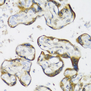 Immunohistochemistry of paraffin-embedded Human placenta using NMT1 Polyclonal Antibody at dilution of 1:100 (40x lens) .