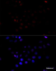 Immunofluorescence analysis of HeLa cells using TBP Polyclonal Antibody at dilution of 1:100 (40x lens) . Blue: DAPI for nuclear staining.