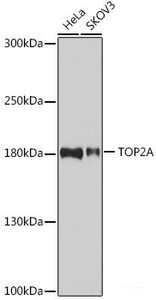 Western blot analysis of extracts of various cell lines using TOP2A Polyclonal Antibody at dilution of 1:1000.
