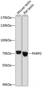 Western blot analysis of extracts of various cell lines using PARP2 Polyclonal Antibody at dilution of 1:1000.