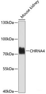 Western blot analysis of extracts of Mouse kidney using CHRNA4 Polyclonal Antibody at dilution of 1:1000.