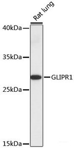 Western blot analysis of extracts of Rat lung using GLIPR1 Polyclonal Antibody at dilution of 1:1000.