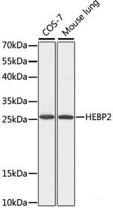 Western blot analysis of extracts of various cell lines using HEBP2 Polyclonal Antibody at dilution of 1:1000.