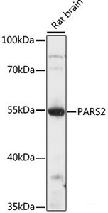Western blot analysis of extracts of Rat brain using PARS2 Polyclonal Antibody at dilution of 1:1000.