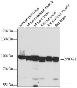 Western blot analysis of extracts of various cell lines using ZNF471 Polyclonal Antibody at dilution of 1:1000.