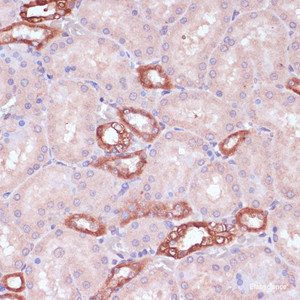 Immunohistochemistry of paraffin-embedded Rat kidney using UGT2B15 Polyclonal Antibody at dilution of 1:100 (40x lens) .