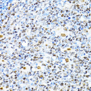 Immunohistochemistry of paraffin-embedded Human appendix using XRCC4 Polyclonal Antibody at dilution of 1:100 (40x lens) .