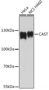 Western blot analysis of extracts of various cell lines using CAST Polyclonal Antibody at dilution of 1:1000.