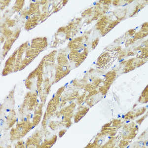 Immunohistochemistry of paraffin-embedded Mouse heart using CASQ2 Polyclonal Antibody at dilution of 1:100 (40x lens) .