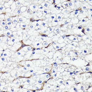 Immunohistochemistry of paraffin-embedded Human liver using CD44 Polyclonal Antibody at dilution of 1:100 (40x lens) .