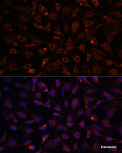 Immunofluorescence analysis of C6 cells using MyD88 Polyclonal Antibody at dilution of 1:100. Blue: DAPI for nuclear staining.