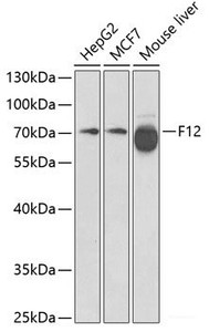 Western blot analysis of extracts of various cell lines using F12 Polyclonal Antibody at dilution of 1:1000.