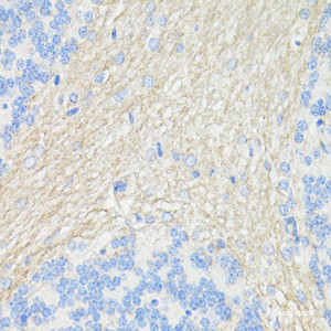 Immunohistochemistry of paraffin-embedded Rat brain using THY1 Polyclonal Antibody at dilution of 1:100 (40x lens) .