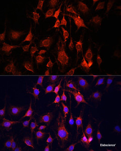 Immunofluorescence analysis of C6 cells using UCP3 Polyclonal Antibody at dilution of 1:100. Blue: DAPI for nuclear staining.