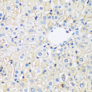 Immunohistochemistry of paraffin-embedded Rat liver using ARL4A Polyclonal Antibody at dilution of 1:100 (40x lens) .