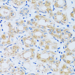 Immunohistochemistry of paraffin-embedded Human stomach using ARPC1A Polyclonal Antibody at dilution of 1:100 (40x lens) .