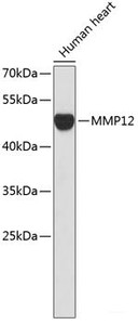 Western blot analysis of extracts of Human heart using MMP12 Polyclonal Antibody.