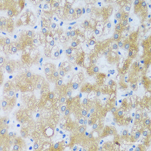 Immunohistochemistry of paraffin-embedded Human liver using ASB4 Polyclonal Antibody at dilution of 1:100 (40x lens) .