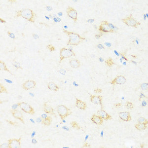 Immunohistochemistry of paraffin-embedded Rat brain using ASIC4 Polyclonal Antibody at dilution of 1:100 (40x lens) .