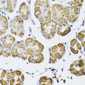 Immunohistochemistry of paraffin-embedded Human stomach using HDAC6 Polyclonal Antibody at dilution of 1:100 (40x lens) .