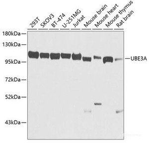 Western blot analysis of extracts of various cell lines using UBE3A Polyclonal Antibody at dilution of 1:1000.