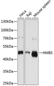Western blot analysis of extracts of various cell lines using HMBS Polyclonal Antibody at dilution of 1:1000.