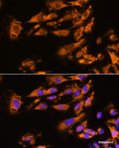 Immunofluorescence analysis of C6 cells using ASPM Polyclonal Antibody at dilution of 1:100. Blue: DAPI for nuclear staining.