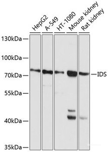 Western blot analysis of extracts of various cell lines using IDS Polyclonal Antibody at dilution of 1:1000.