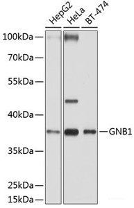 Western blot analysis of extracts of various cell lines using GNB1 Polyclonal Antibody at dilution of 1:1000.