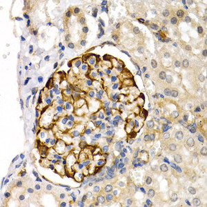 Immunohistochemistry of paraffin-embedded Rat kidney using LIPG Polyclonal Antibody at dilution of 1:200 (40x lens) .
