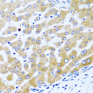 Immunohistochemistry of paraffin-embedded Human liver using CCL21 Polyclonal Antibody at dilution of 1:100 (40x lens) .