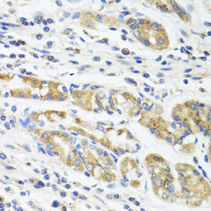 Immunohistochemistry of paraffin-embedded Human stomach using IL11 Polyclonal Antibody at dilution of 1:100 (40x lens) .