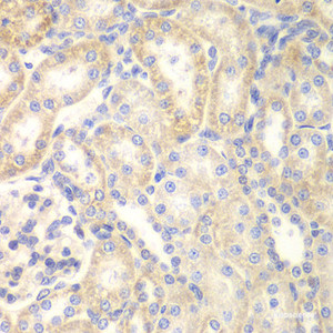 Immunohistochemistry of paraffin-embedded Rat kidney using DLC1 Polyclonal Antibody at dilution of 1:200 (40x lens) .