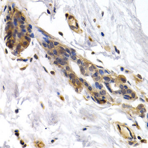 Immunohistochemistry of paraffin-embedded Human normal breast using PKLR Polyclonal Antibody at dilution of 1:200 (40x lens) .