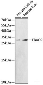 Western blot analysis of extracts of various cell lines using EBAG9 Polyclonal Antibody at dilution of 1:1000.