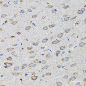 Immunohistochemistry of paraffin-embedded Rat brain using PSMD10 Polyclonal Antibody at dilution of 1:100 (40x lens) .