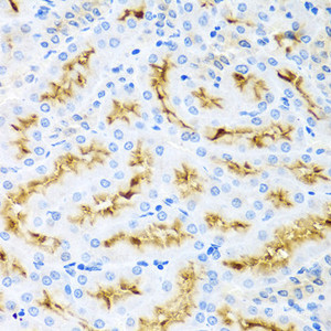 Immunohistochemistry of paraffin-embedded Rat kidney using CCL22 Polyclonal Antibody at dilution of 1:100 (40x lens) .