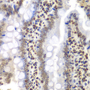 Immunohistochemistry of paraffin-embedded Rat intestine using PSMC3 Polyclonal Antibody at dilution of 1:200 (40x lens) .
