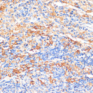 Immunohistochemistry of paraffin-embedded Rat spleen using APCS Polyclonal Antibody at dilution of 1:100 (40x lens) .