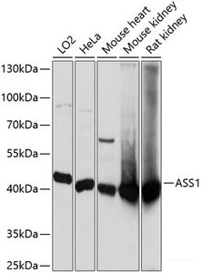 Western blot analysis of extracts of various cell lines using ASS1 Polyclonal Antibody at dilution of 1:3000.