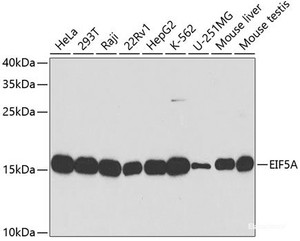 Western blot analysis of extracts of various cell lines using EIF5A Polyclonal Antibody at dilution of 1:1000.