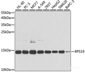 Western blot analysis of extracts of various cell lines using RPS19 Polyclonal Antibody at dilution of 1:1000.
