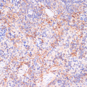 Immunohistochemistry of paraffin-embedded Rat spleen using NT5E / CD73 Polyclonal Antibody at dilution of 1:200 (40x lens) .