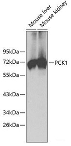 Western blot analysis of extracts of various cell lines using PCK1 Polyclonal Antibody.