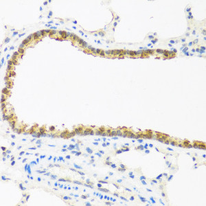Immunohistochemistry of paraffin-embedded Rat lung using CDKN2C Polyclonal Antibody at dilution of 1:100 (40x lens) .