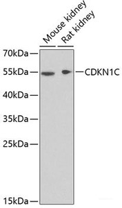 Western blot analysis of extracts of various cell lines using CDKN1C Polyclonal Antibody at dilution of 1:1000.