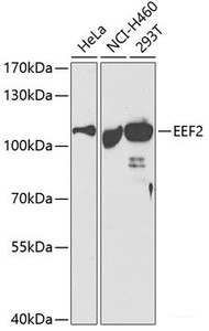 Western blot analysis of extracts of various cell lines using EEF2 Polyclonal Antibody at dilution of 1:500.