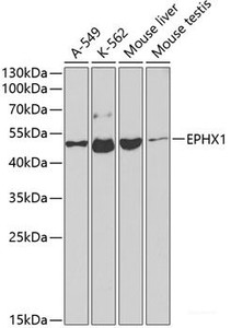 Western blot analysis of extracts of various cell lines using EPHX1 Polyclonal Antibody at dilution of 1:1000.